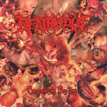 DEATHTOPIA - Caesarean Section