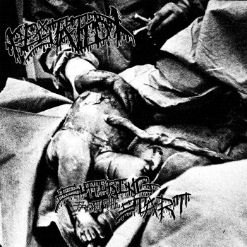 GESTATION - Suffering From The Start