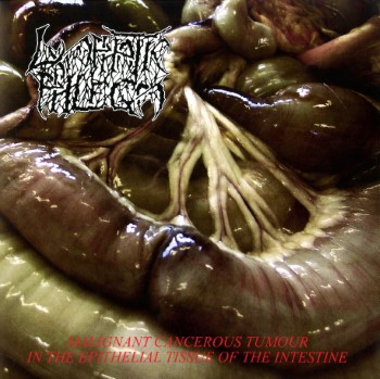 LYMPHATIC PHLEGM / FLESH GRINDER - Split