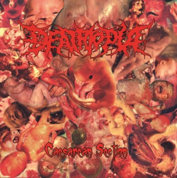 DEATHTOPIA - Caesarean Section