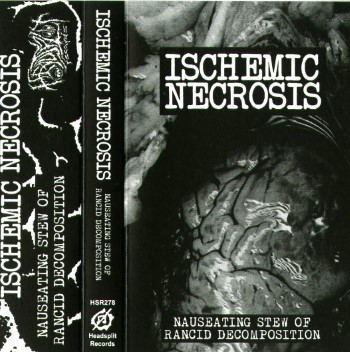 ISCHEMIC NECROSIS - Nauseating Stew Of Rancid Decomposition