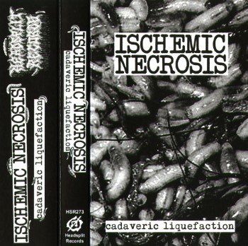 ISCHEMIC NECROSIS - Cadaveric Liquefaction