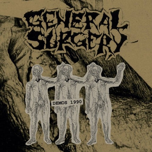 GENERAL SURGERY - Demos 1990