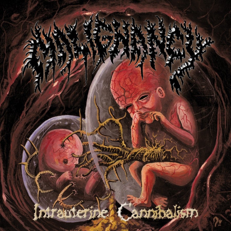 MALIGNANCY - Intrauterine Cannibalism