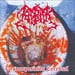KABAK - Descomposicion Cerebral