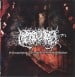 HIPERMENORREA / DISGORGEMENT OF INTESTINAL LYMPHATIC SUPPURATION - Split