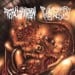 PULMONARY FIBROSIS / FETAL DOMINATION - Split Goregrind