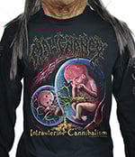 MALIGNANCY - Intrauterine Cannibalism